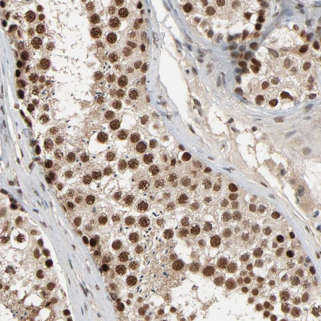 Валидация AssayVector ARM2466(4389)