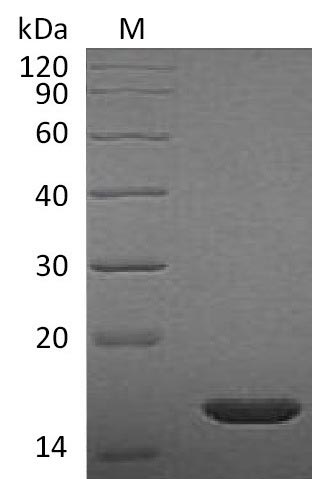 SDS-PAGE