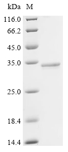 SDS-PAGE