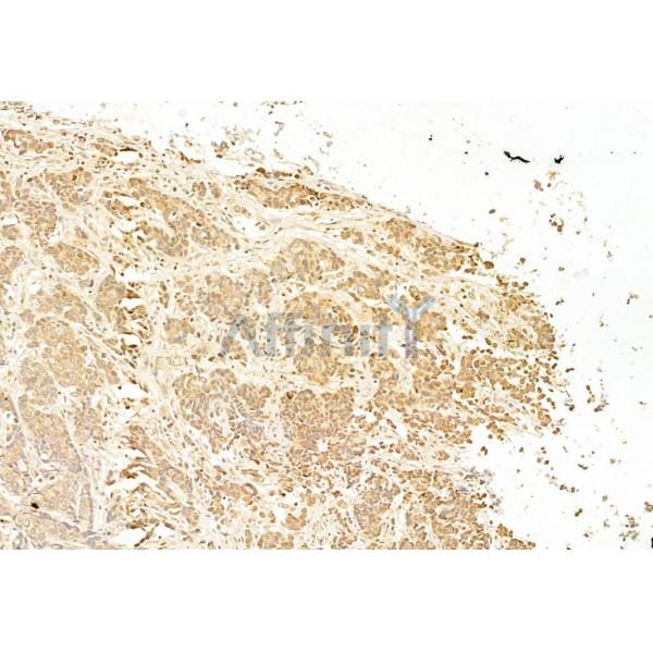 Валидация Affinity AF6058 - 3261