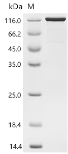 SDS-PAGE