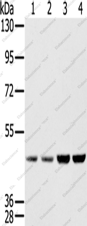 Вестерн-блоттинг, SSB, клетки HeLa, Raji, 231 и K562