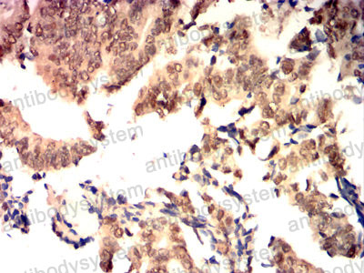 Валидация AntibodySystem RHE05804