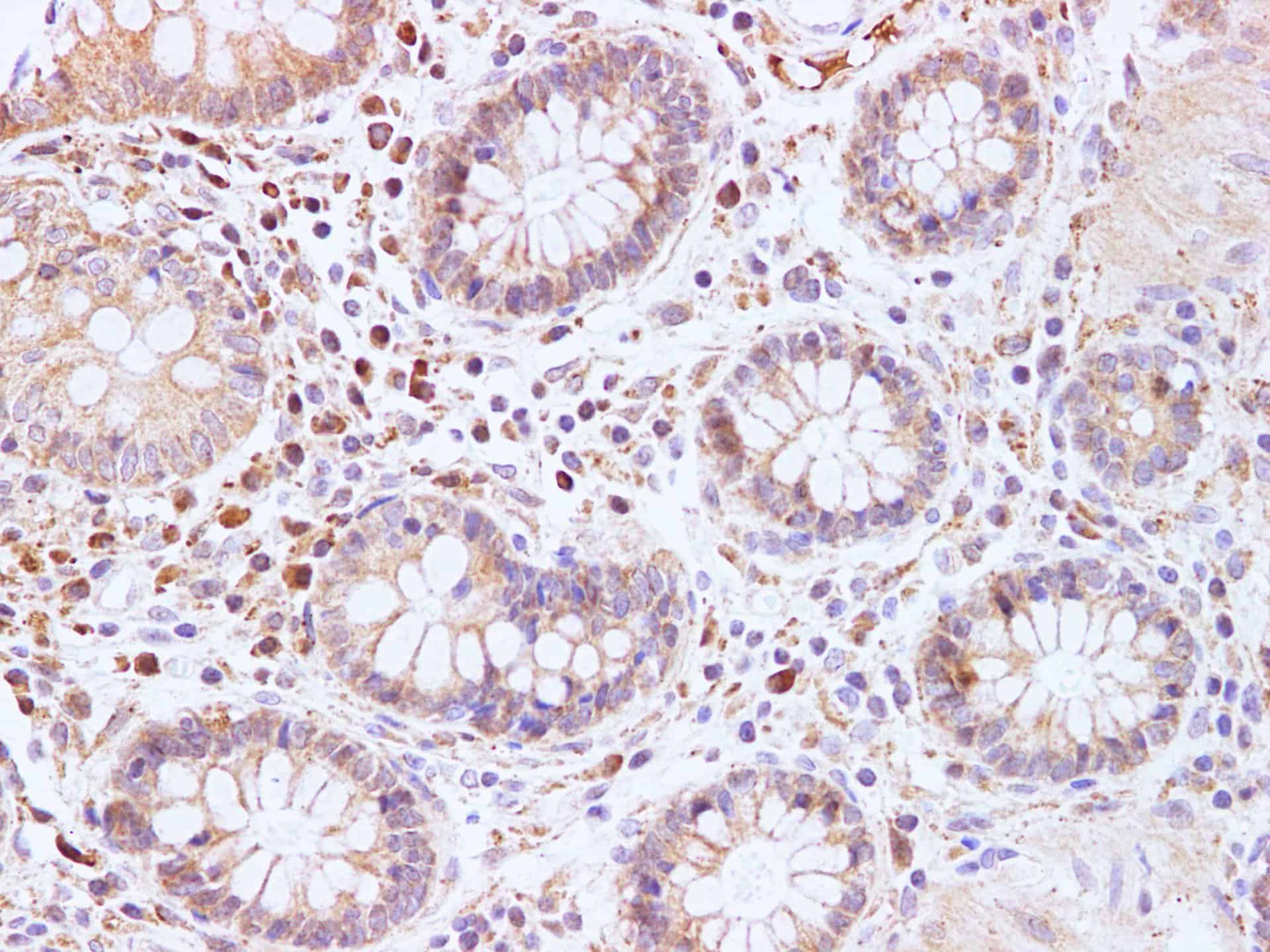 Иммуногистохимия, BRCA2, ткань толстой кишки человека