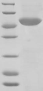 SDS-PAGE