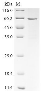 SDS-PAGE