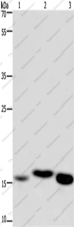 Вестерн-блоттинг, Cytochrome b5, ткань почки мыши, фетальной печени человека и печени мыши