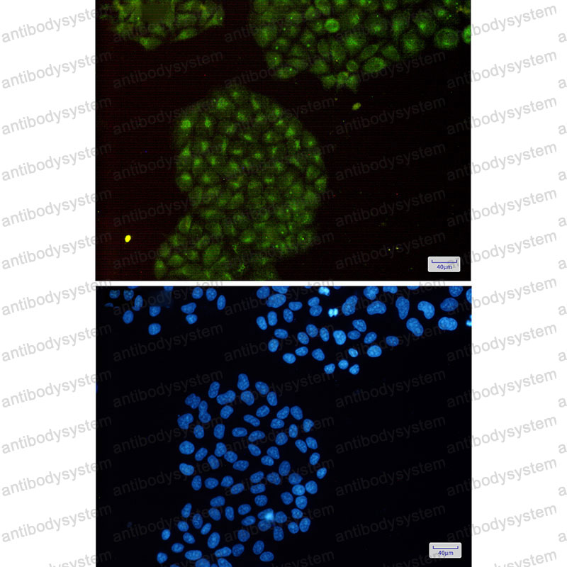 Валидация IF - AntibodySystem RHD76101