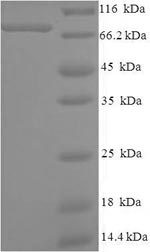 SDS-PAGE
