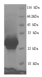 SDS-PAGE