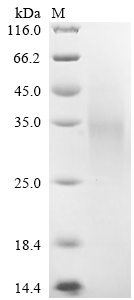SDS-PAGE
