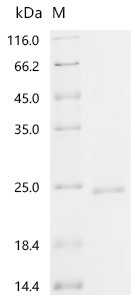 SDS-PAGE
