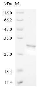 SDS-PAGE