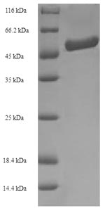 SDS-PAGE
