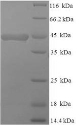 SDS-PAGE