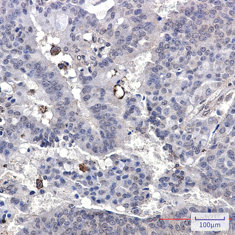 Валидация AntibodySystem RHE62403