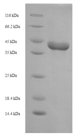 SDS-PAGE