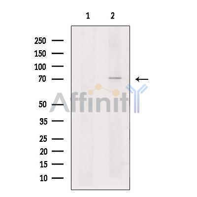 Валидация Affinity DF10336 - 5958