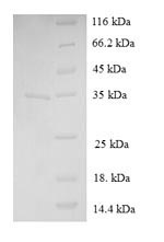 SDS-PAGE