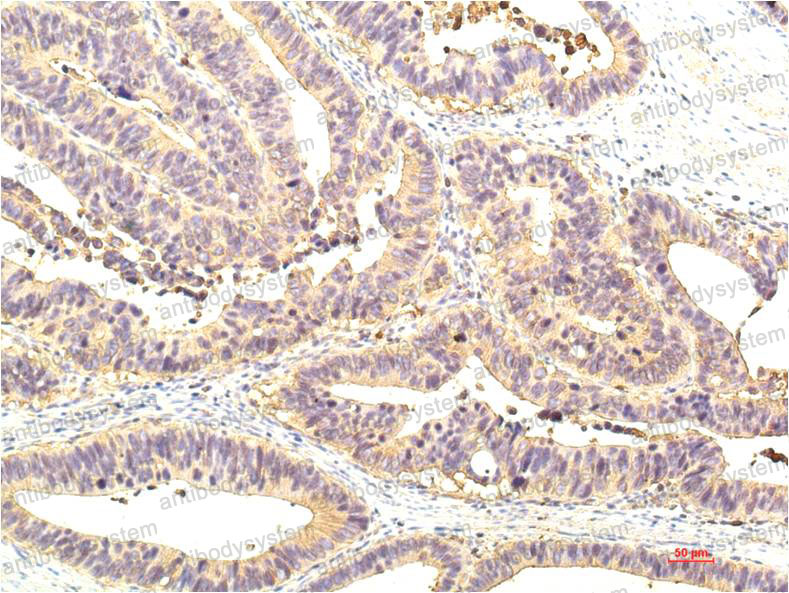 Валидация AntibodySystem RHE34309 (2089)