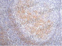 Валидация AntibodySystem RHC21301