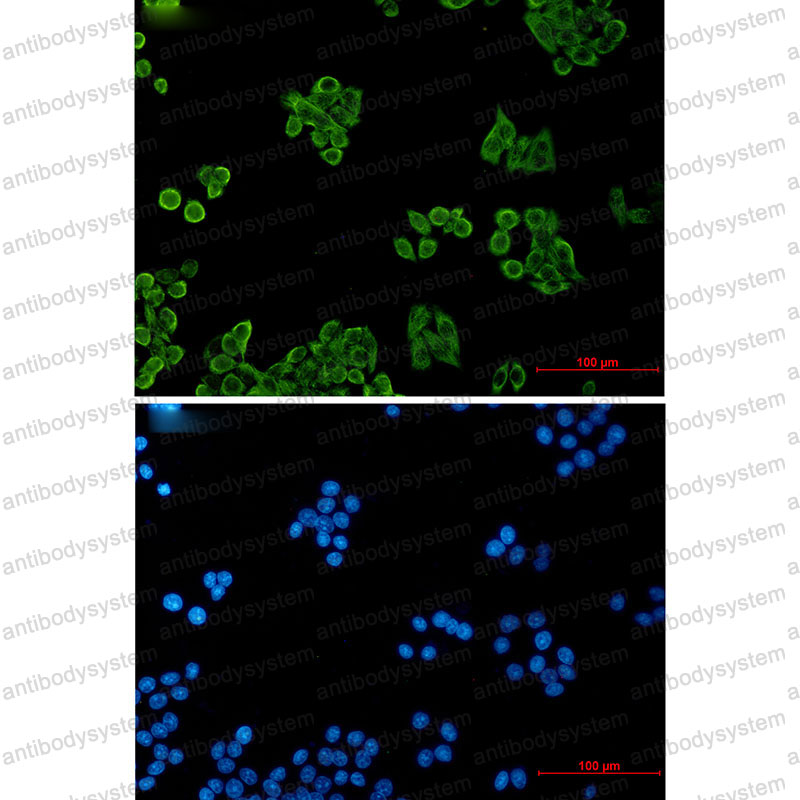 Валидация IF - AntibodySystem RHB24101