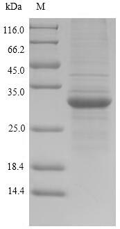SDS-PAGE