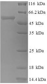 SDS-PAGE