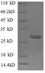 SDS-PAGE