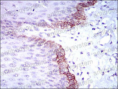 Валидация AntibodySystem RHE22301