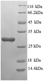 SDS-PAGE