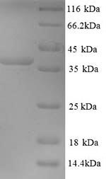 SDS-PAGE