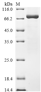 SDS-PAGE