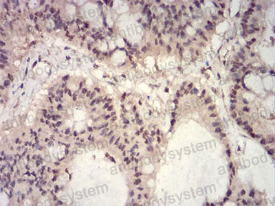 Валидация AntibodySystem RHJ11902 (3337)