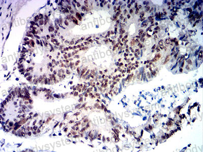 Валидация AntibodySystem RHC07601 (594)