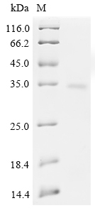 SDS-PAGE