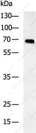Вестерн-блоттинг, ALB, клетки HepG2