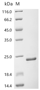 SDS-PAGE
