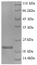 SDS-PAGE