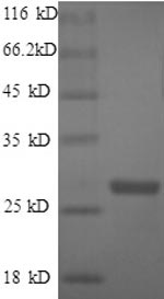 SDS-PAGE
