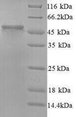 SDS-PAGE