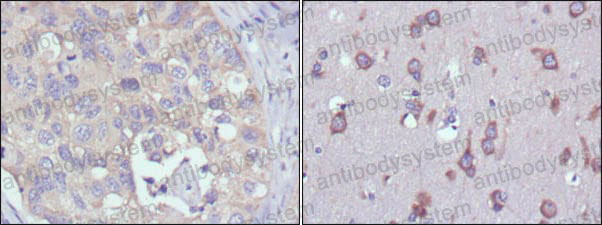 Валидация AntibodySystem RHE36202