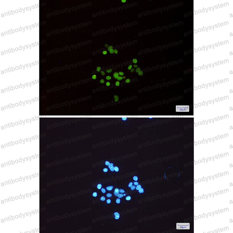 Валидация IF - AntibodySystem RHD66501