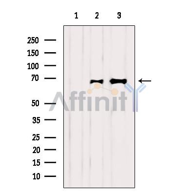 Валидация Affinity AF6244 - 3488