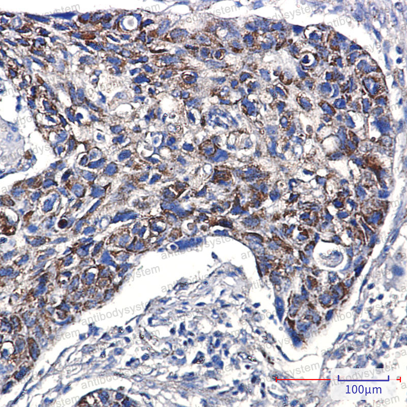 Валидация AntibodySystem RHJ87301