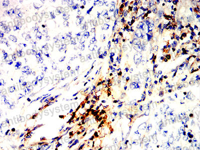 Валидация AntibodySystem RHG76502 (3072)