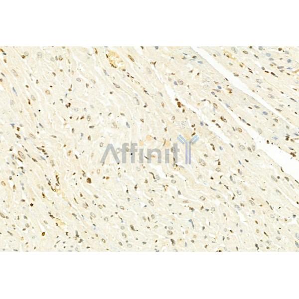 Валидация Affinity DF3182 - 13989