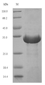 SDS-PAGE