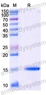 Валидация SDS-PAGE - AntibodySystem RHC19801
