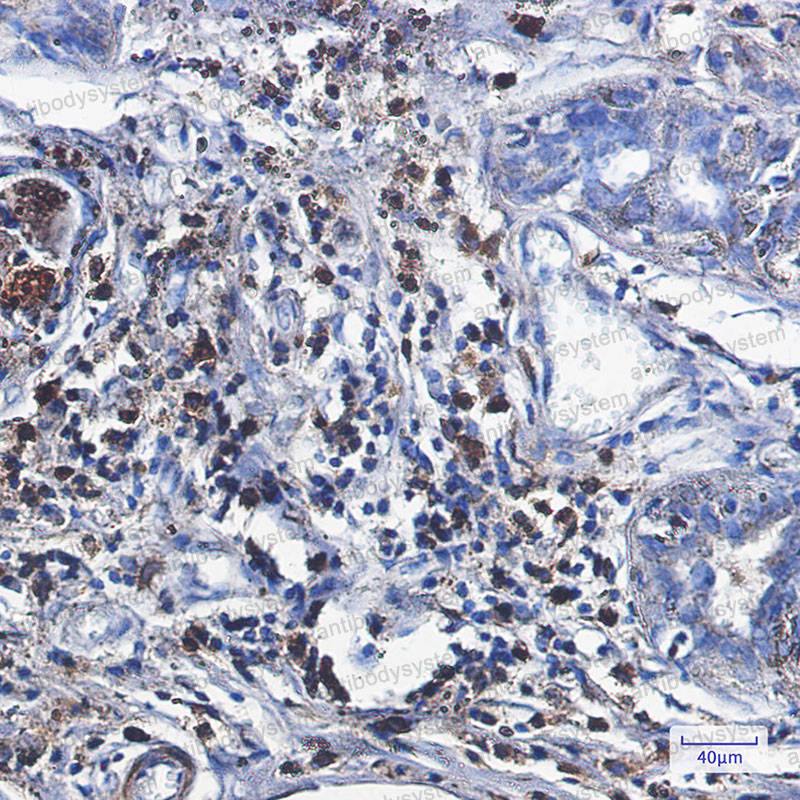 Валидация AntibodySystem RHC05302